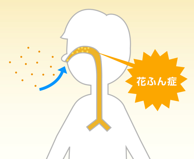 花ふんは鼻の中に入り、花ふん症をひきおこす